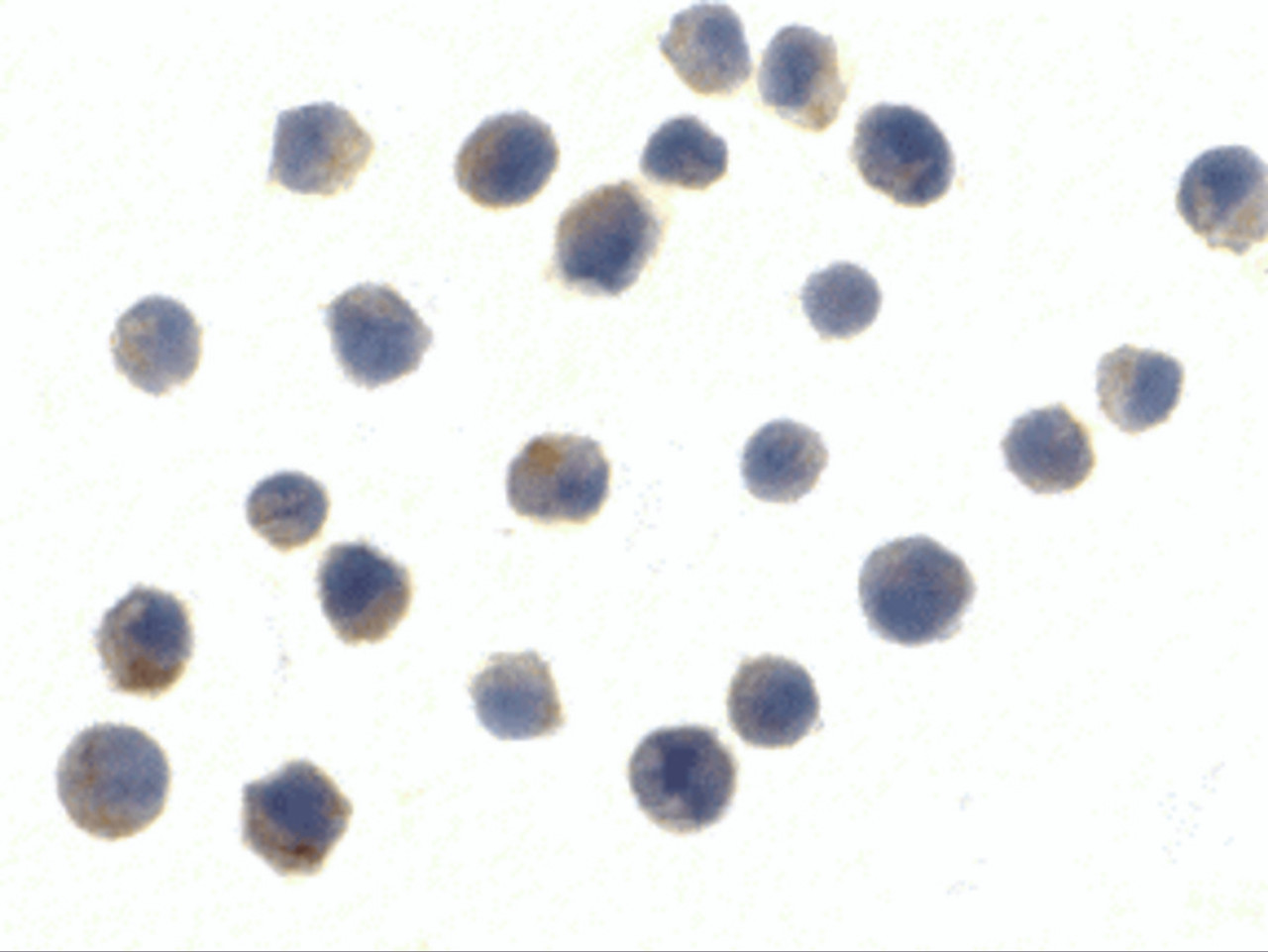 Immunocytochemistry of TLR6 in Jurkat cells with TLR6 antibody at 10 ug/mL.