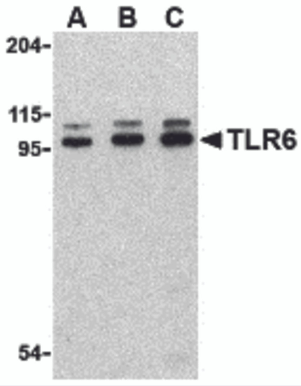 Western blot analysis of TLR6 in Jurkat cell lysate with TLR6 antibody at (A) 0.5, (B) 1 and (C) 2 &#956;g/mL.