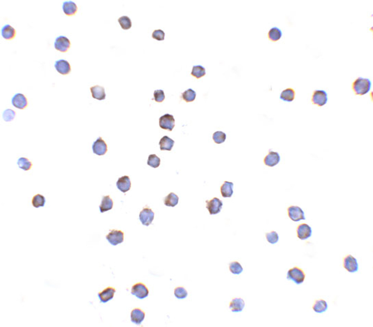 Immunocytochemistry of TLR6 in Jurkat cells with TLR6 antibody at 2 ug/mL.