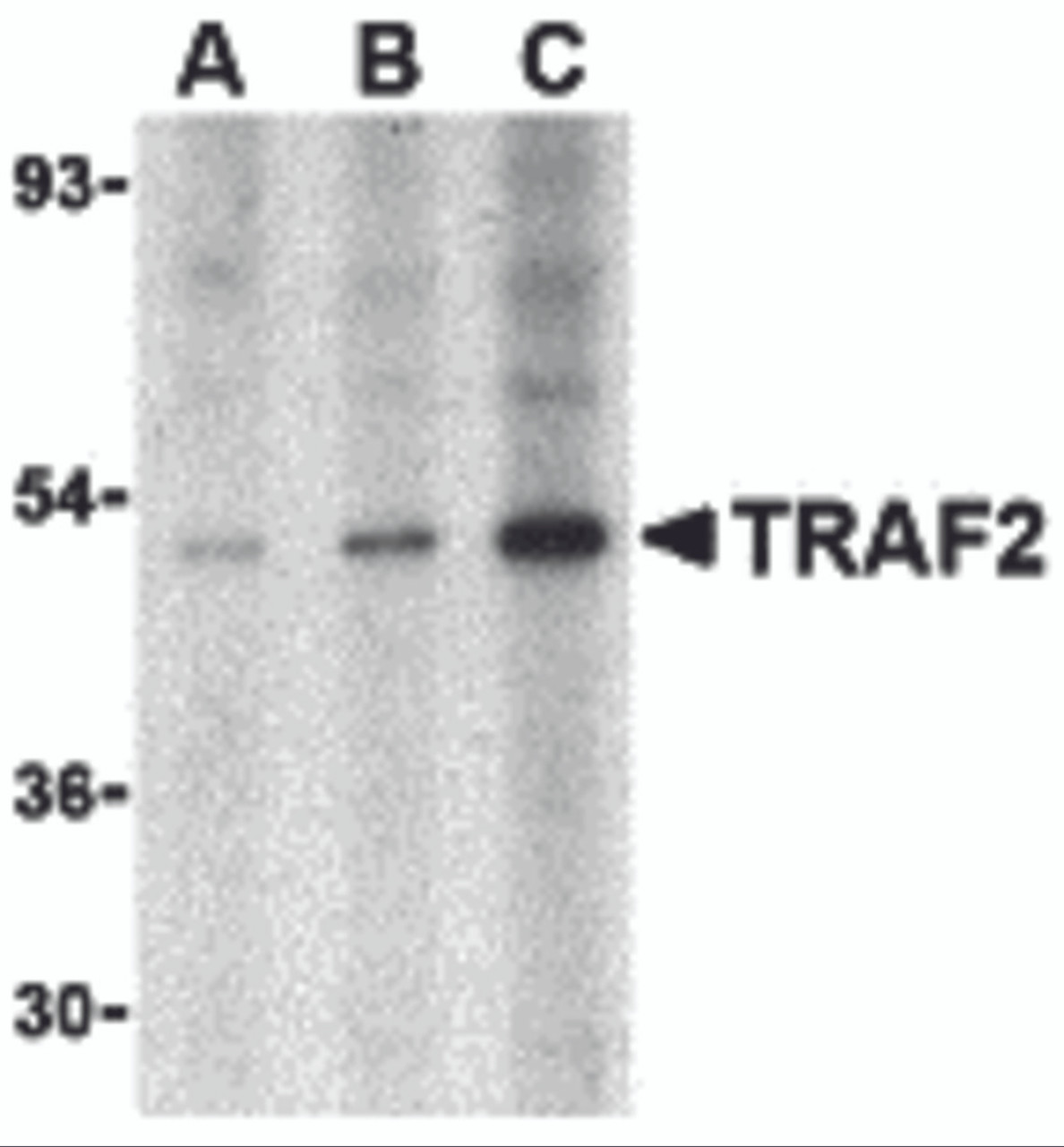 Western blot analysis of TRAF2 in human liver tissue lysate with TRAF2 antibody at (A) 0.5, (B) 1 and (C) 2 &#956;g/mL.