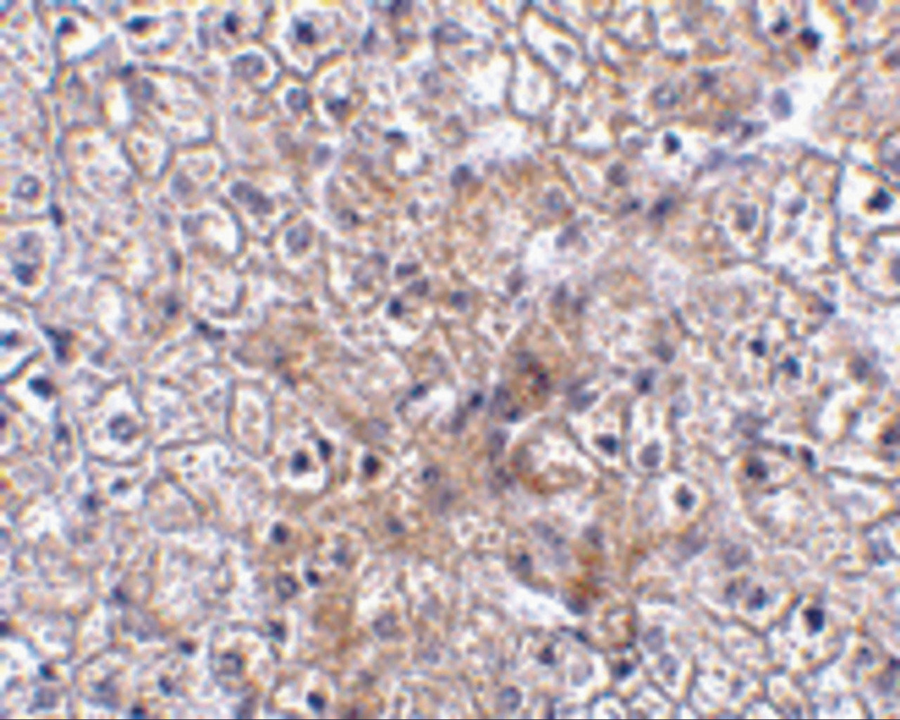 Immunohistochemistry of TRAF2 in human liver tissue with TRAF2 antibody at 2.5 ug/mL.