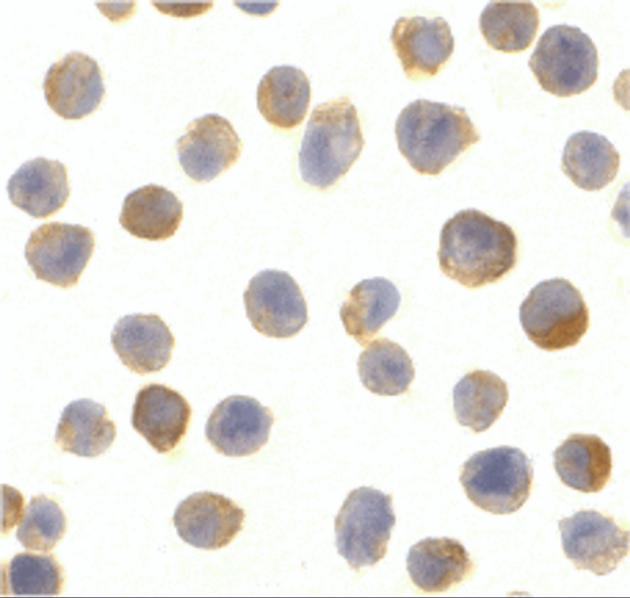 Immunocytochemistry of CTRP2 in Jurkat cells with CTRP2 antibody at 10 ug/mL.