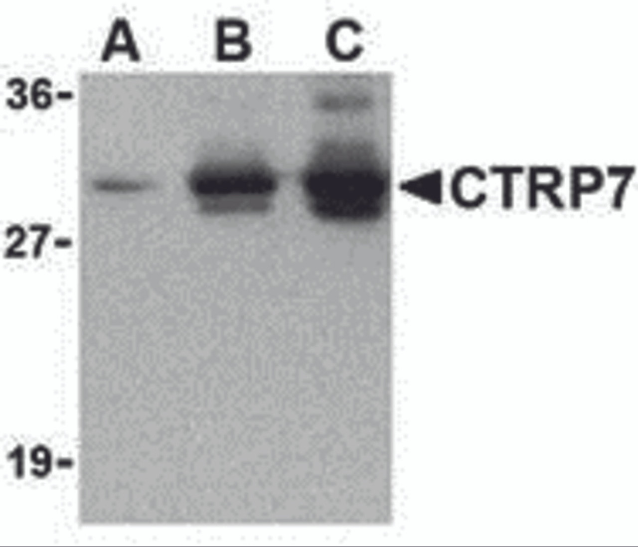Western blot of recombinant CTRP7: (A) 5 ng, (B) 25 ng, and (C) 50 ng with CTRP2 antibody at 1 &#956;g/mL.