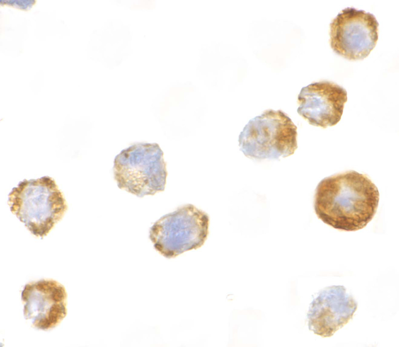 Immunocytochemistry of ASK1 in A431 cells with ASK1 antibody at 2 ug/mL.