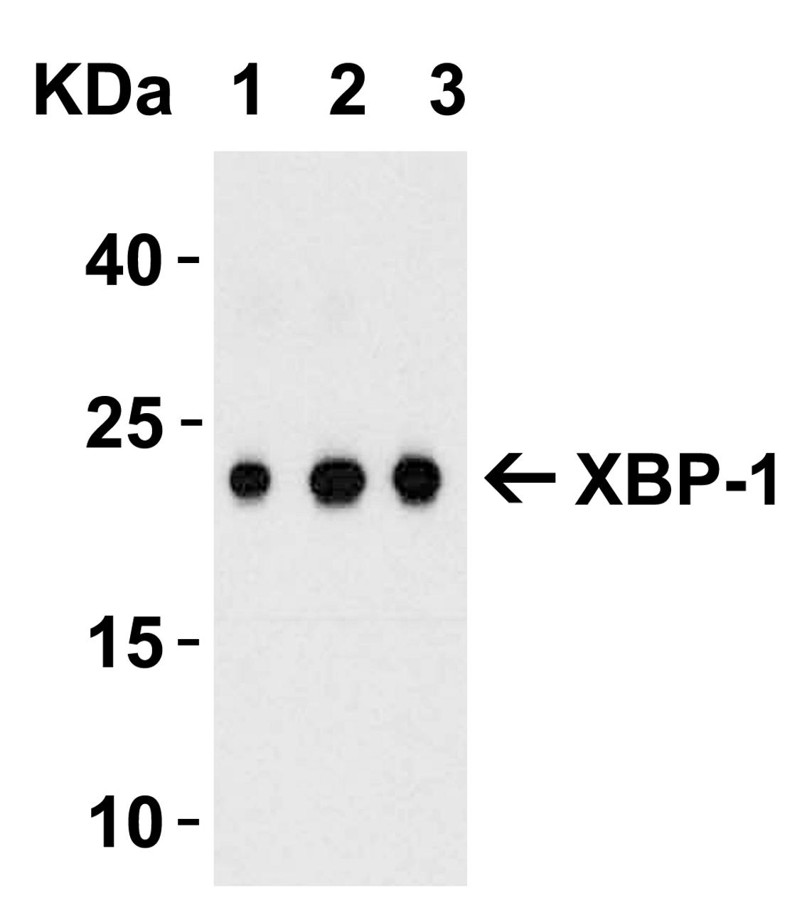 Figure 2 Western Blot Validation with Recombinant Protein
Loading: 100 ng of human XBP-1 recombinant protein per lane.
Antibodies: XBP-1 3687 (A: 0.5 ug/mL, B: 1 ug/mL and C: 2 ug/mL) , 1h incubation at RT in 5% NFDM/TBST.
Secondary: Goat anti-rabbit IgG HRP conjugate at 1:10000 dilution.
Observed at around 23kD.