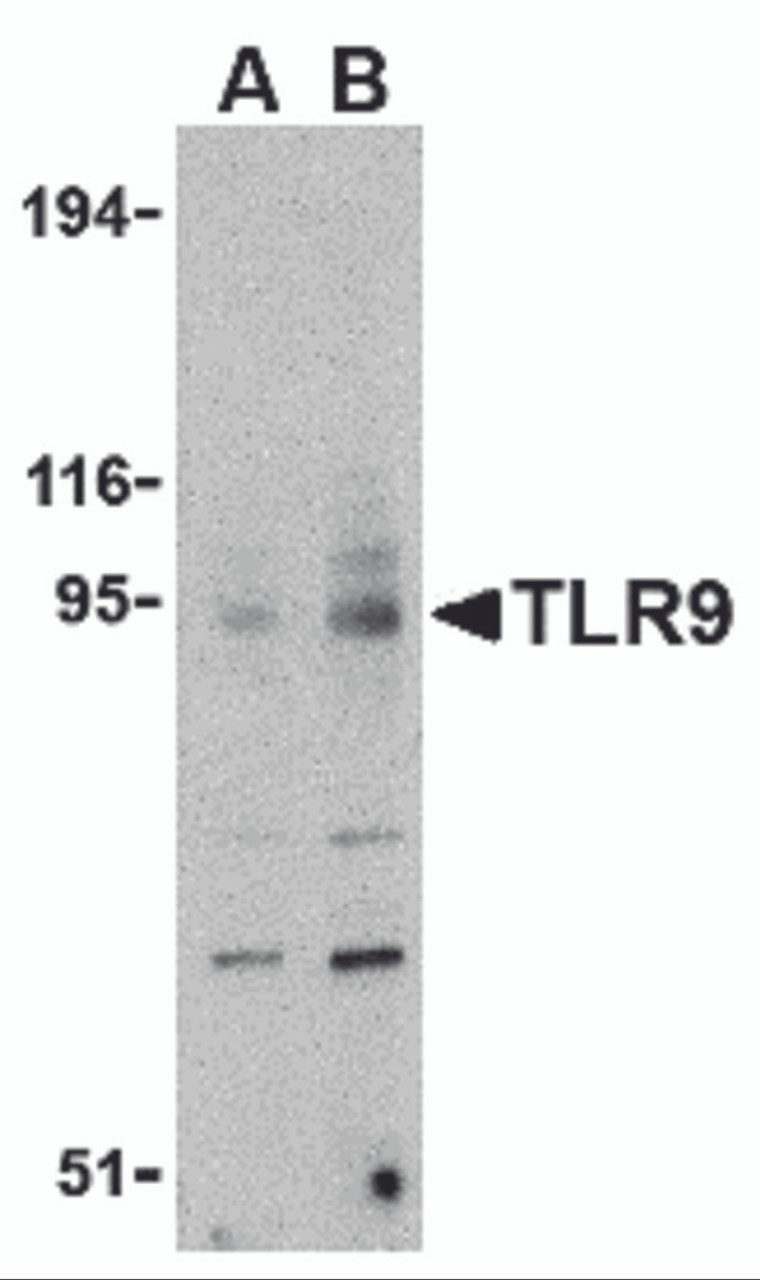 Western blot analysis of TLR9 in mouse spleen cell lysate with TLR9 antibody at (A) 0.5 and (B) 1 &#956;g/mL.