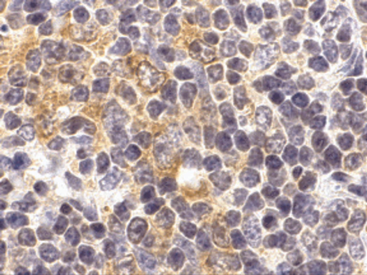 Immunohistochemistry of TLR9 in mouse spleen cells with TLR9 antibody at 2 ug/mL.