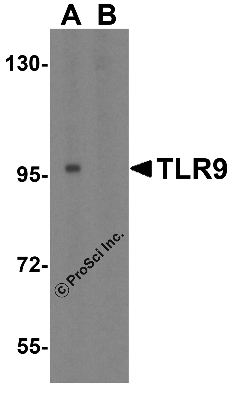 Western blot analysis of TLR9 in Jurkat cell lysate with TLR9 antibody at 1 &#956;g/mL in (A) the absence and (B) the presence of blocking peptide