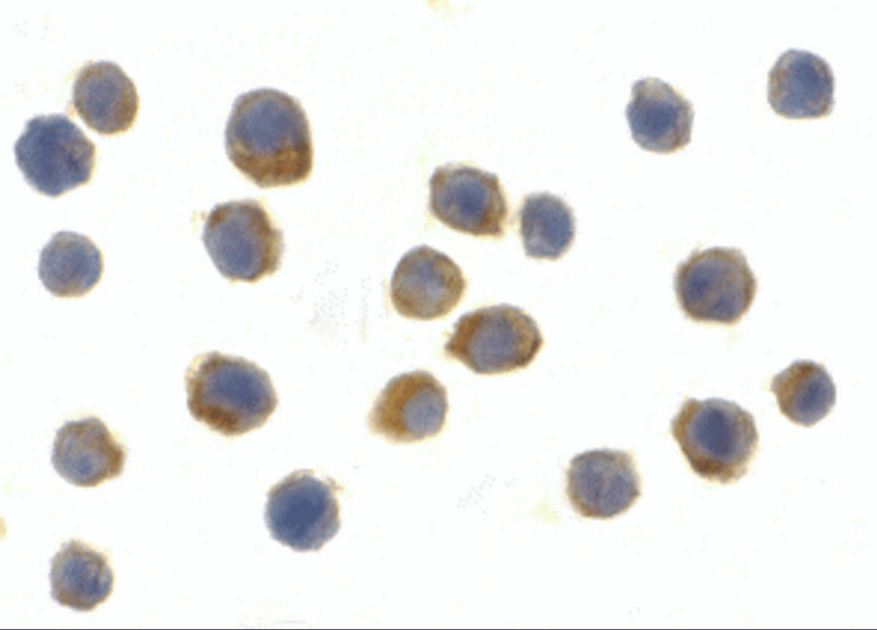 Immunocytochemistry of TLR9 in Jurkat cells with TLR9 antibody at 2 ug/mL.