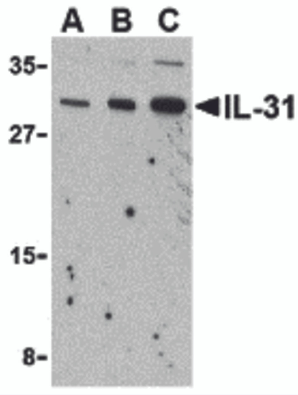 Western blot analysis of IL-31 in RAW264.7 cell lysate with IL-31 antibody at (A) 2.5, (B) 5 and (C) 10 &#956;g/mL.