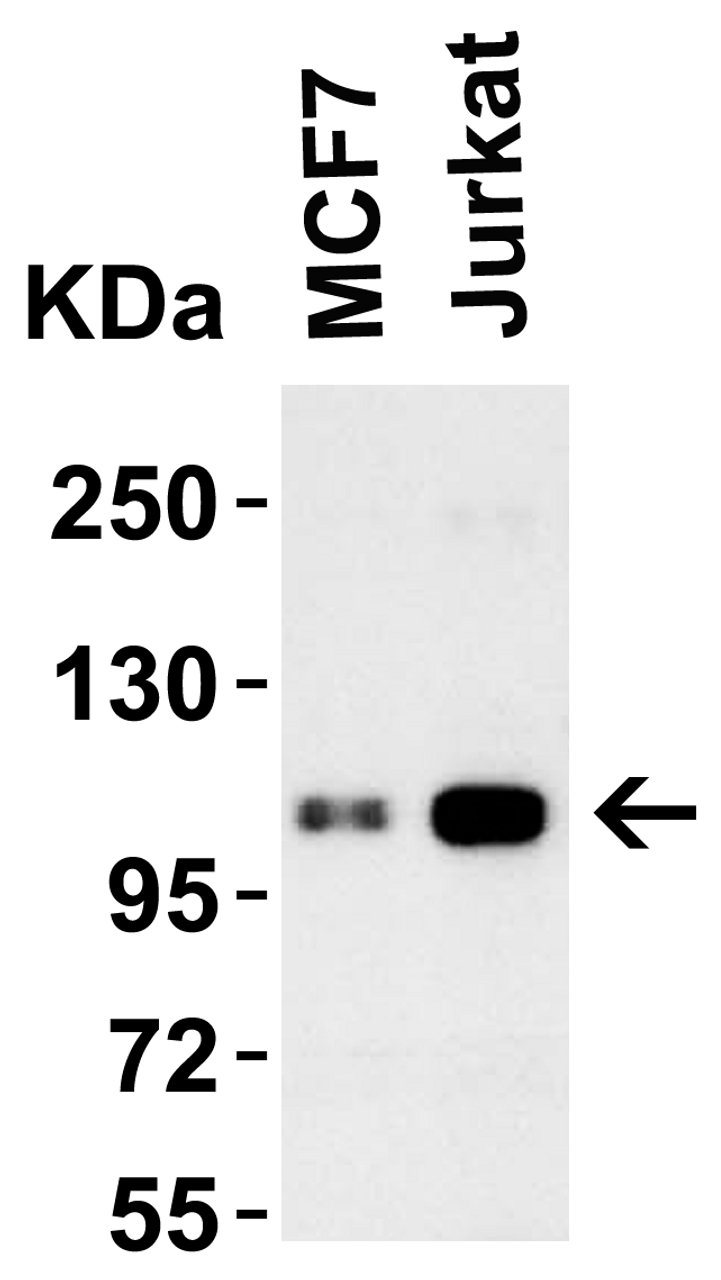 Figure 1 Western Blot Validation in Human Cell Lines
Loading: 15 &#956;g of lysates per lane.
Antibodies: LSD1 3763 ( 1 &#956;g/mL) , 1h incubation at RT in 5% NFDM/TBST.
Secondary: Goat anti-rabbit IgG HRP conjugate at 1:10000 dilution.