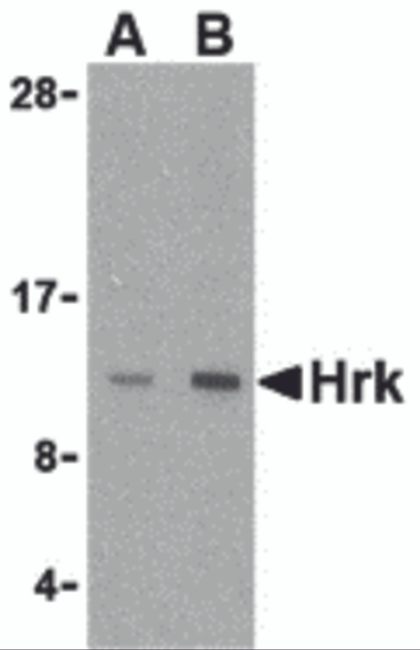 Western blot analysis of Hrk in mouse pancreas tissue lysate with Hrk antibody at (A) 2.5 and (B) 5 &#956;g/mL.