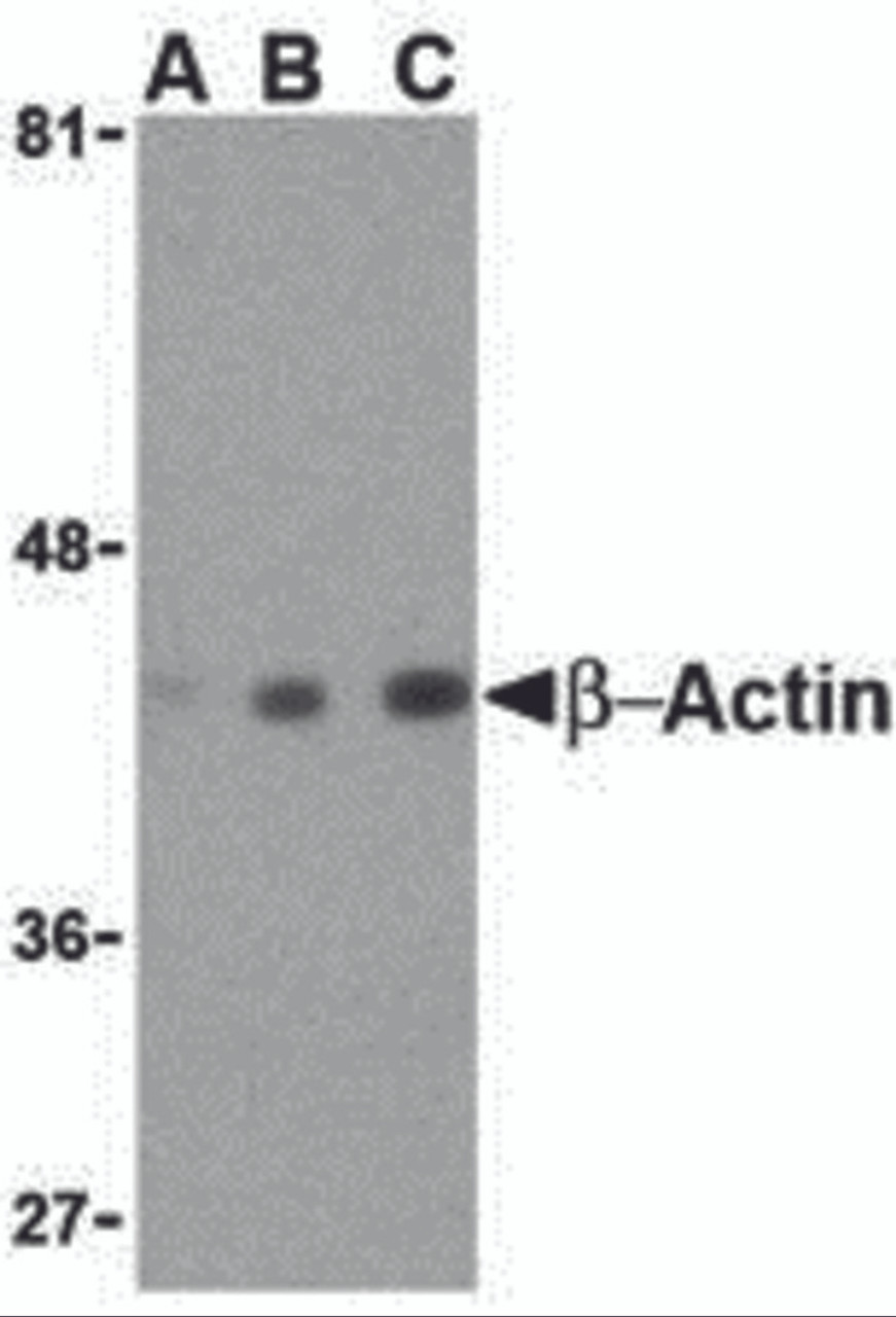 Western blot analysis of beta-actin in HeLa cell lysate with beta-actin antibody at (A) 0.5, (B) 1 and (C) 2 &#956;g/mL.