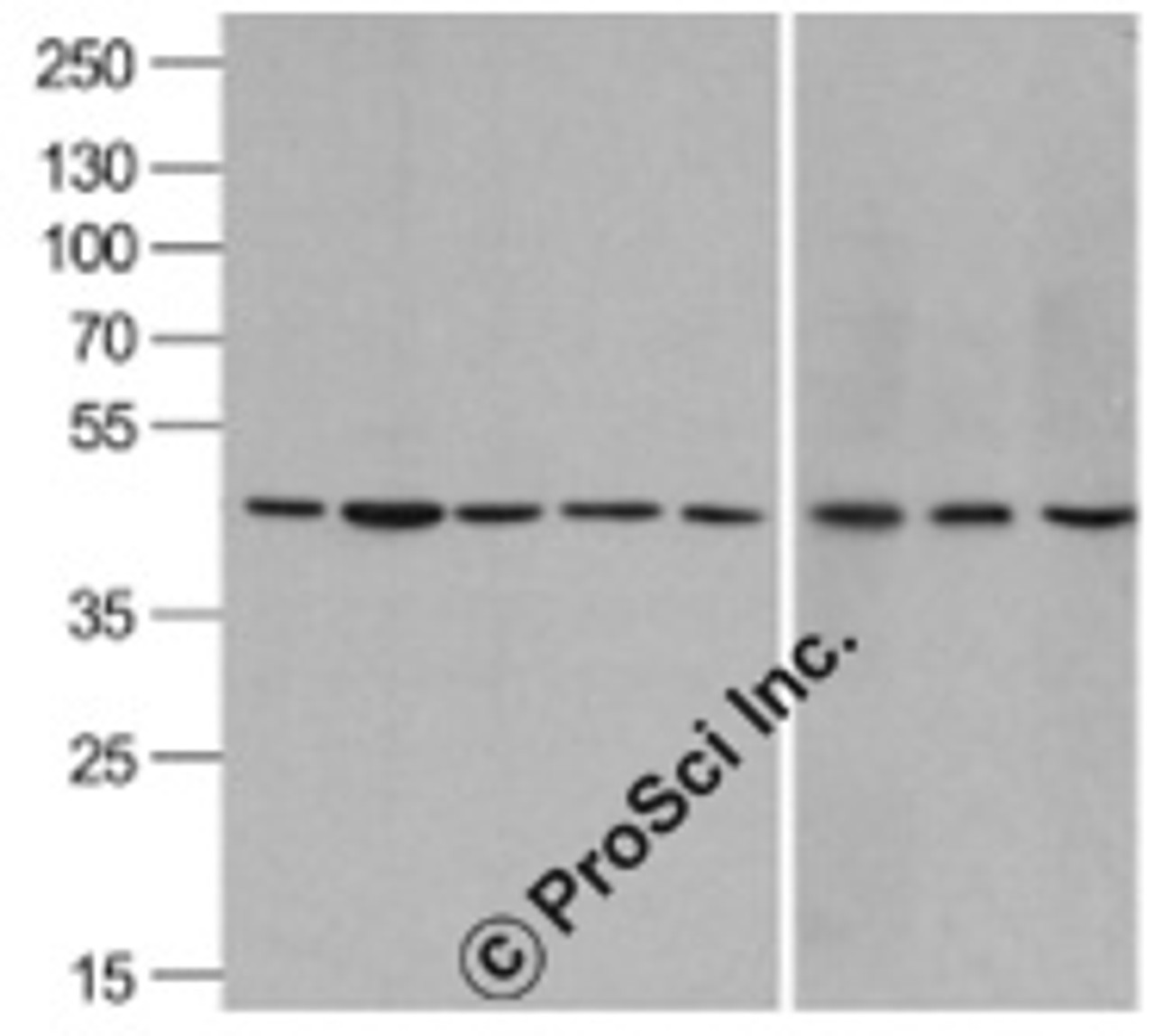 Western blot analysis of beta-Actin in A431, Daudi, HepG2, HL60, Jurkat, Human brain, Mouse lung, and Chicken liver lysate with beta-Actin antibody at 1 &#956;g/mL.