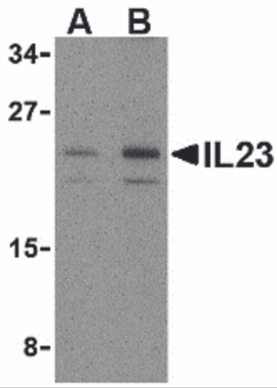 Figure 1 Western Blot Validation in Mouse Pancreas Tissue Lysate
Loading: 15 &#956;g of lysates per lane.
Antibodies: IL-23 3795 (A: 1 &#956;g/mL, B: 2 &#956;g/mL) , 1h incubation at RT in 5% NFDM/TBST.
Secondary: Goat anti-rabbit IgG HRP conjugate at 1:10000 dilution.