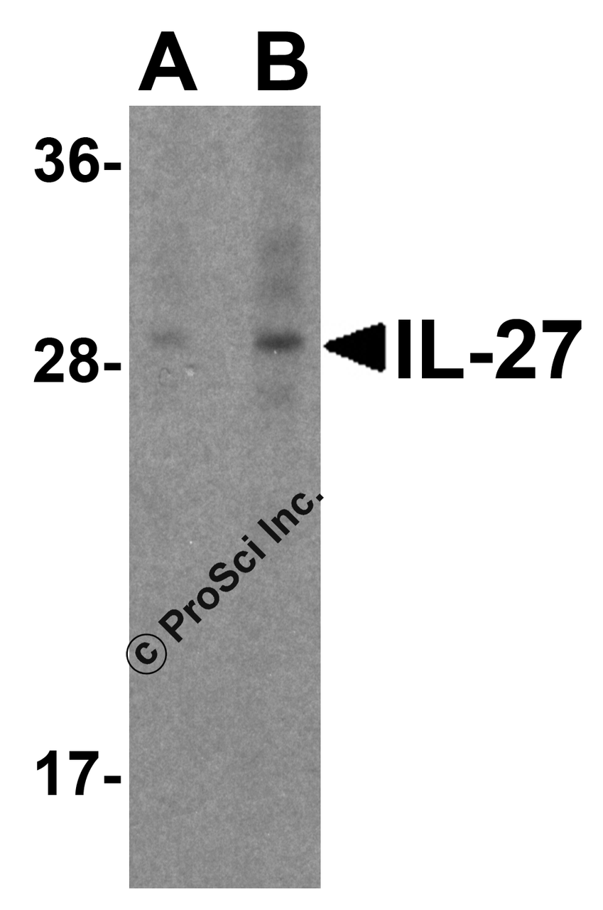 Figure 1 Western Blot Validation in Mouse A20 Cells
Loading: 15 &#956;g of lysates per lane.
Antibodies: IL-27 3797, (A: 1 &#956;g/mL, B: 2 &#956;g/mL) , 1h incubation at RT in 5% NFDM/TBST.
Secondary: Goat anti-rabbit IgG HRP conjugate at 1:10000 dilution.