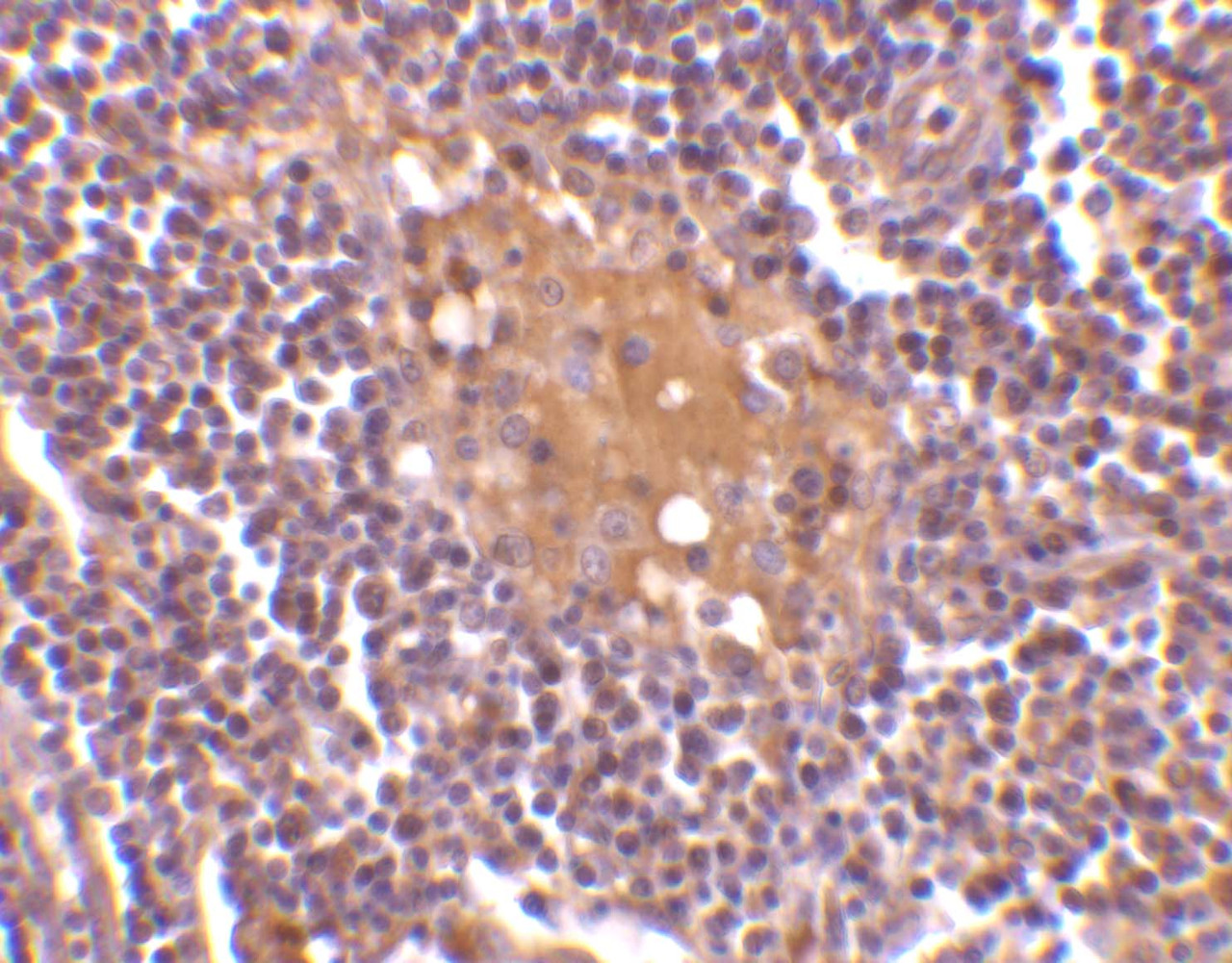 Immunohistochemistry of AIM in human lymph node tissue with AIM antibody at 10 ug/mL.