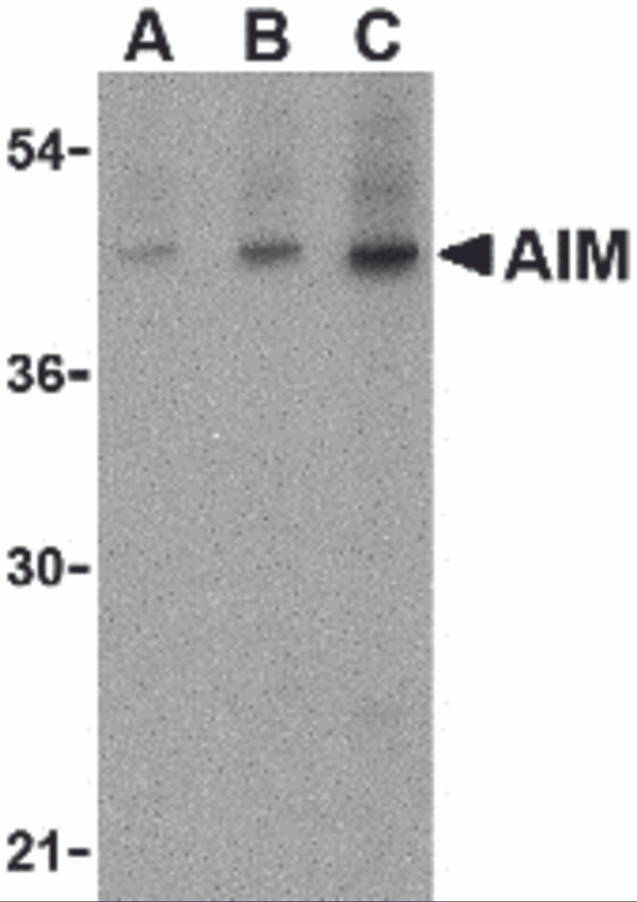 Western blot analysis of AIM in human lymph node tissue lysate with AIM antibody at (A) 1, (B) 2 and (C) 4 &#956;g/mL.