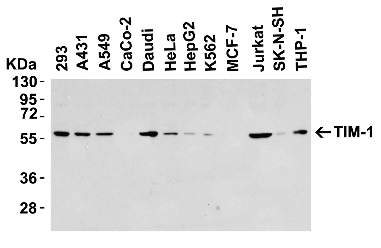 Figure 1 Western Blot Validation in Human Cell Lines
Loading: 15 &#956;g of lysates per lane.
Antibodies: TIM-1 3809 (8 &#956;g/mL) , overnight incubation at 4&#730; C in 5% NFDM/TBST.
Secondary: Goat anti-rabbit IgG HRP conjugate at 1:10000 dilution.