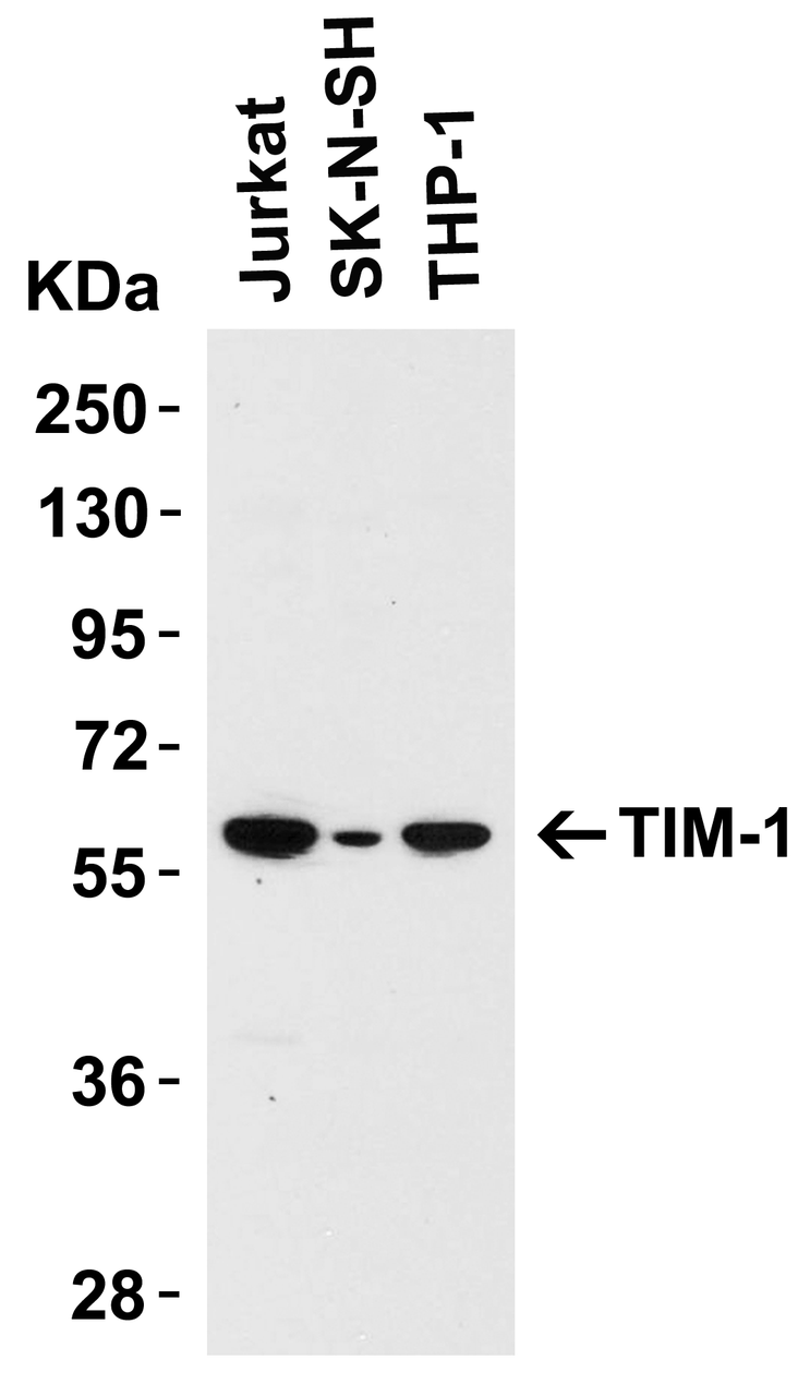 Figure 1 Western Blot Validation in Human Cell Lines
Loading: 15 &#956;g of lysates per lane.
Antibodies: TIM-1 3811 (1 &#956;g/mL) , 1 h incubation at RT in 5% NFDM/TBST.
Secondary: Goat anti-rabbit IgG HRP conjugate at 1:10000 dilution.