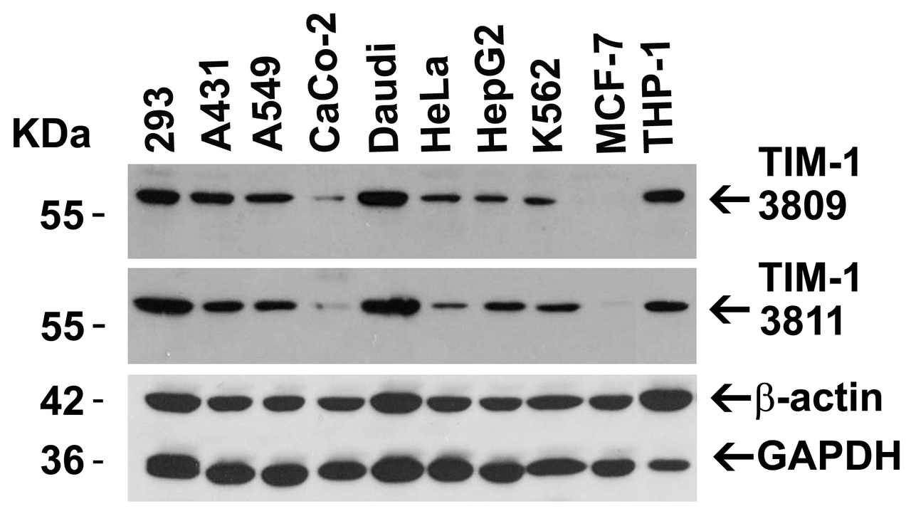 Figure 2 Independent Antibody Validation (IAV) via Protein Expression Profile in Cell Lines
Loading: 15 ug of lysates per lane.
Antibodies: TIM-1 3809 (8 ug/mL) , TIM-1 3811 (1 ug/mL) , beta-actin (1 ug/mL) , and GAPDH (0.02 ug/mL) , overnight incubation at 4&#730; C (3809) or 1h incubation at RT in 5% NFDM/TBST.
Secondary: Goat anti-rabbit IgG HRP conjugate at 1:10000 dilution.