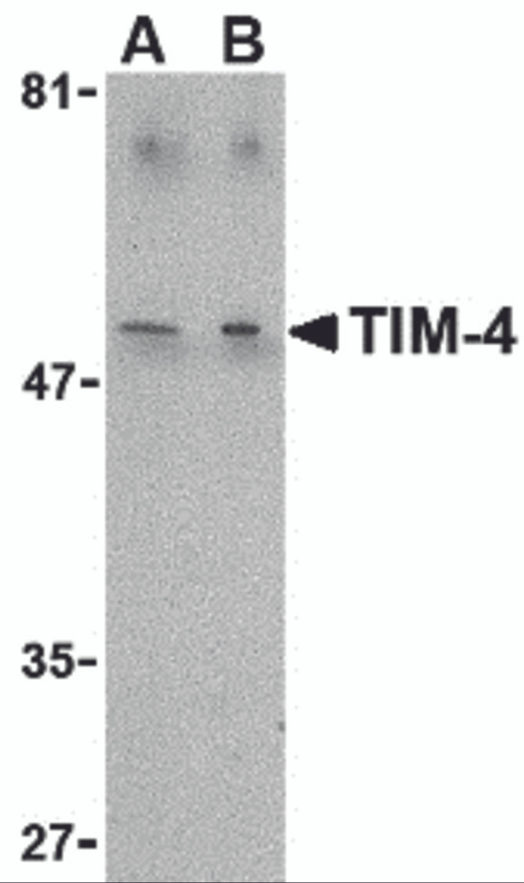 Western blot analysis of TIM-4 in Jurkat lysate with TIM-4 antibody at (A) 1 and (B) 2 &#956;g/mL.