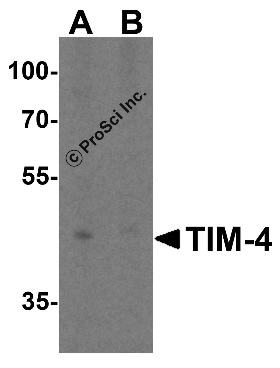 Western blot analysis of TIM-4 in RAW264.7 cell lysate with TIM-4 antibody at 2 &#956;g/mL in (A) the absence and (B) the presence of blocking peptide.