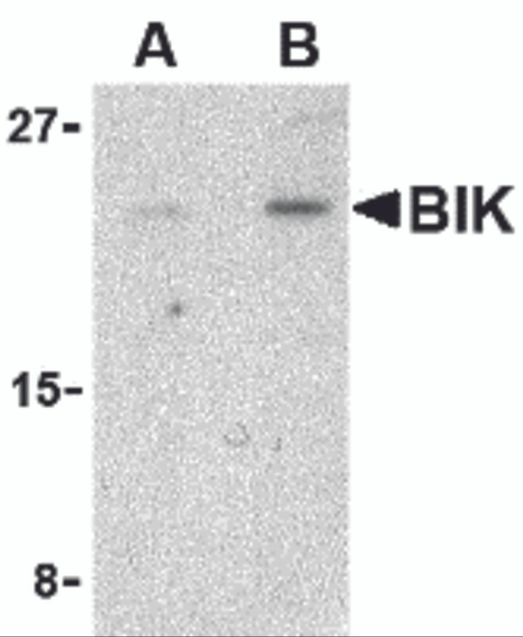 Western blot analysis of BIK in Jurkat cell lysate with BIK antibody at (A) 1 and (B) 2 &#956;g/mL.