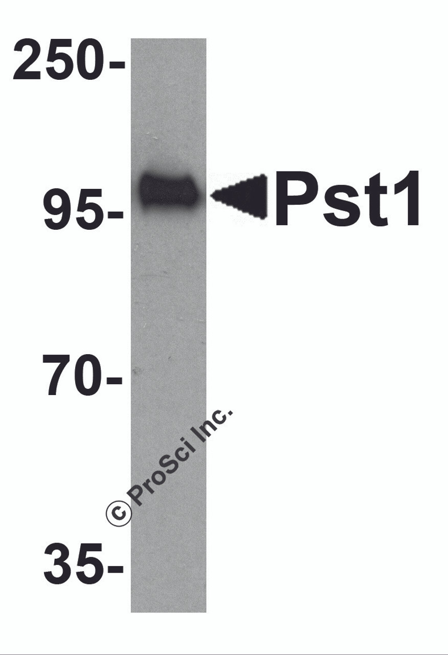 Western blot analysis of TM yeast Pst1 protein (50 ng) with Pst1 antibody at 1 &#956;g/mL.