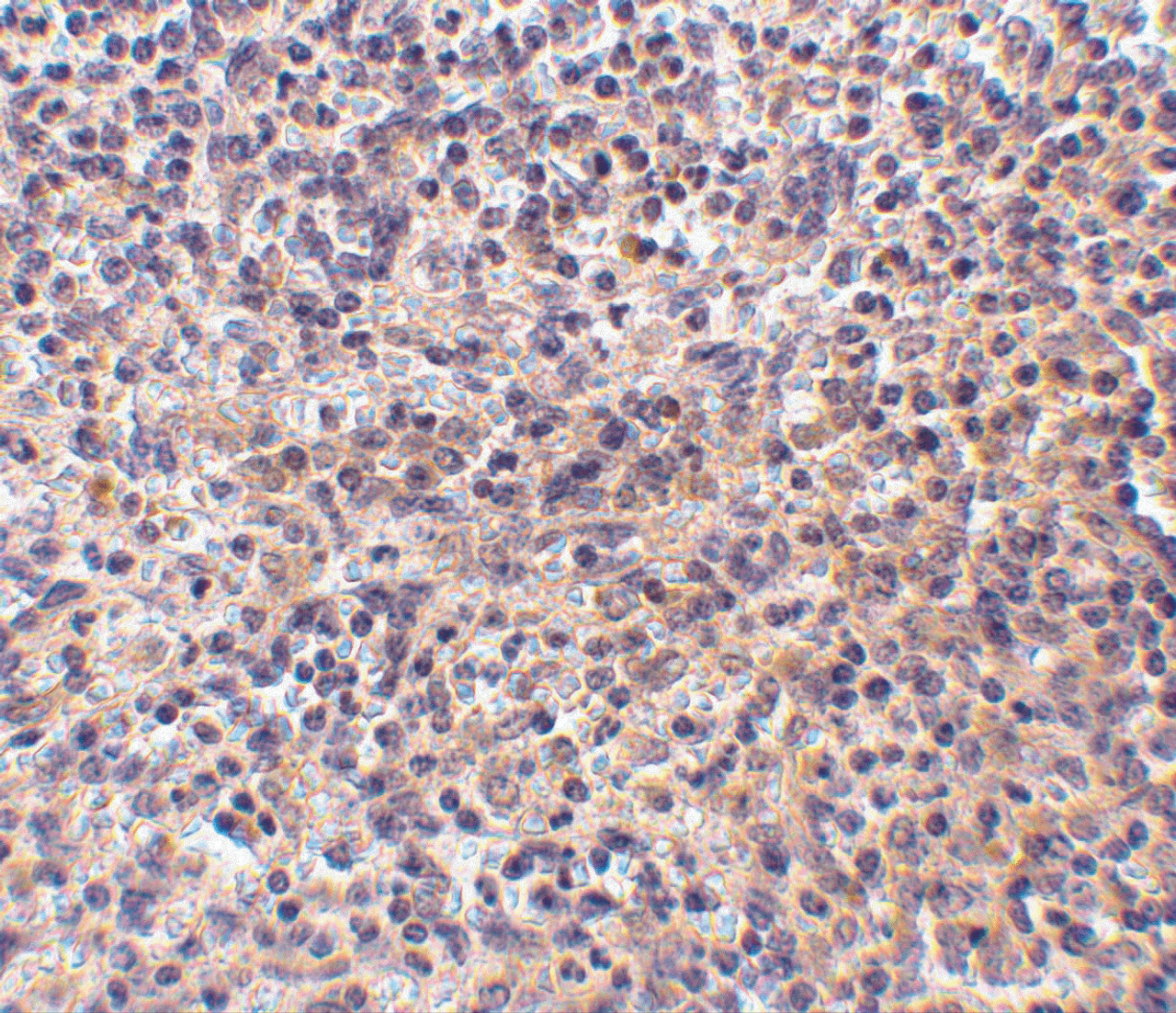 Immunohistochemistry of RP105 in human spleen tissue withRP105 antibody at 10 ug/mL.