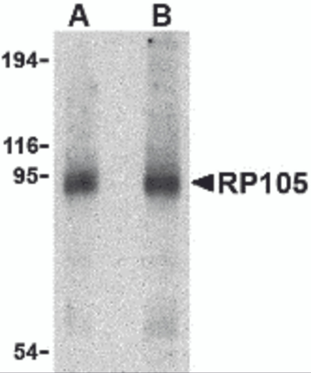 Western blot analysis of RP105 in human spleen tissue lysate with RP105 antibody at (A) 0.5 and (B) 1 &#956;g/mL.