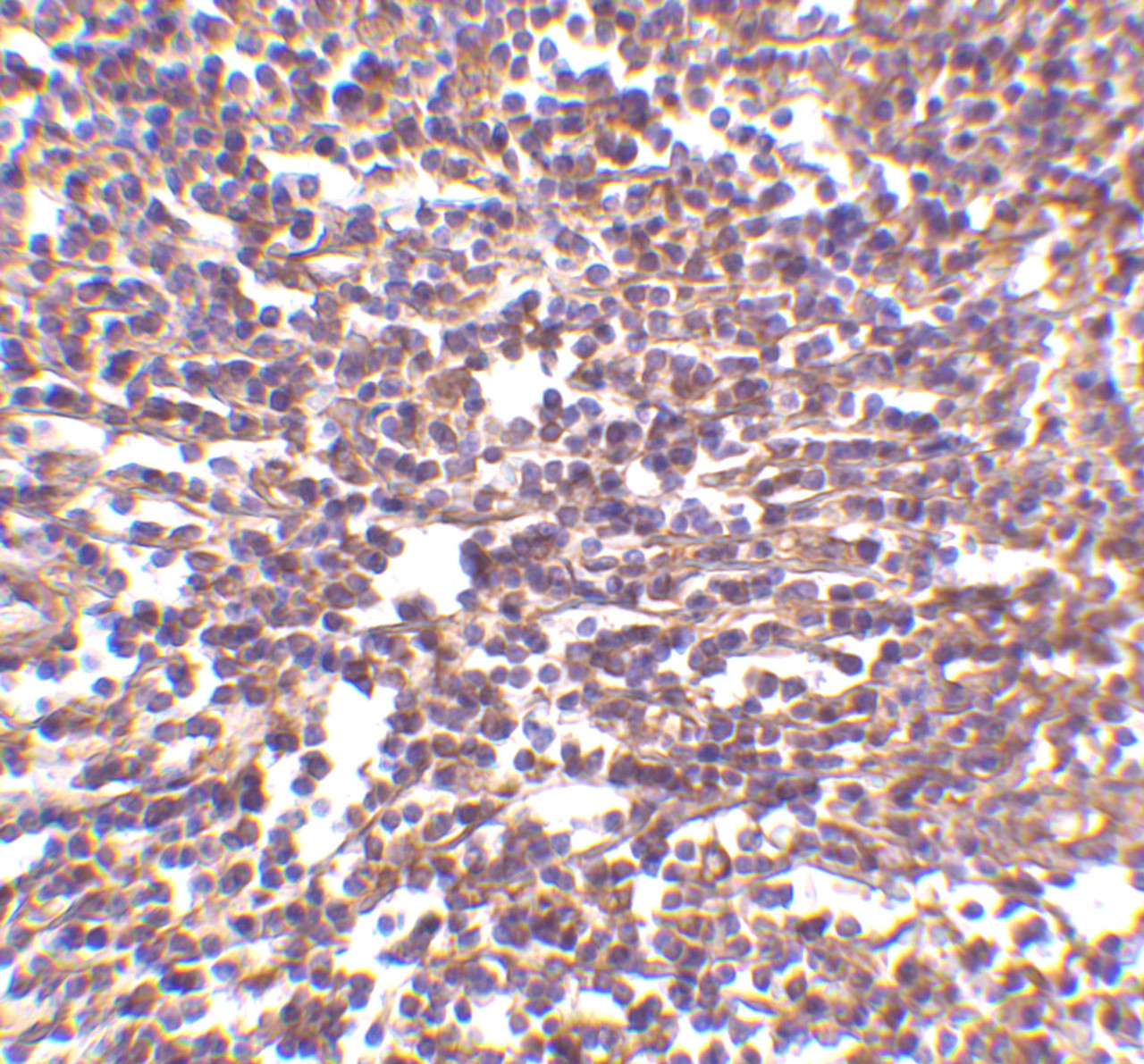 Immunohistochemistry of RP105 in human spleen tissue with RP105 antibody at 2 ug/mL.