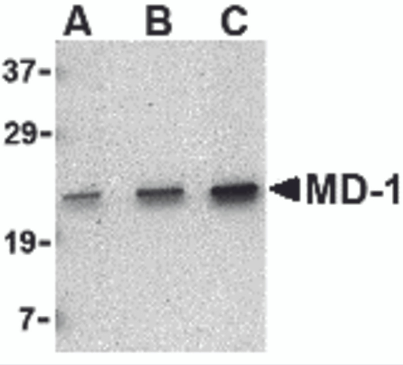 Western blot analysis of MD-1 in Daudi cell lysate with MD-1 antibody at (A) 0.5, (B) 1 and (C) 2 &#956;g/mL.