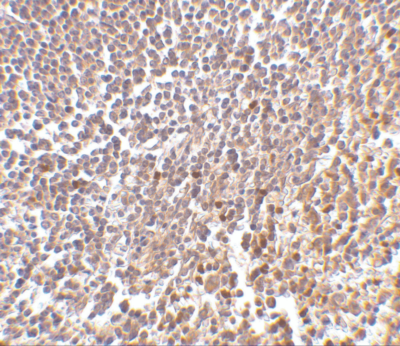 Immunohistochemistry of MD-1 in human spleen tissue with MD-1 antibody at 2 ug/mL.