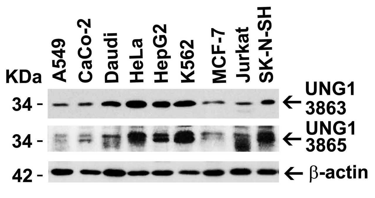 Figure 2 Independent Antibody Validation (IAV) via Protein Expression Profile in Human Cell Lines
Loading: 15 ug of lysates per lane.
Antibodies: UNG1, 3863 (0.5 ug/mL) , UNG1, 3865 (4 ug/mL) , beta-actin 3779 (1 ug/mL) , 1h incubation at RT in 5% NFDM/TBST.
Secondary: Goat anti-rabbit IgG HRP conjugate at 1:10000 dilution.