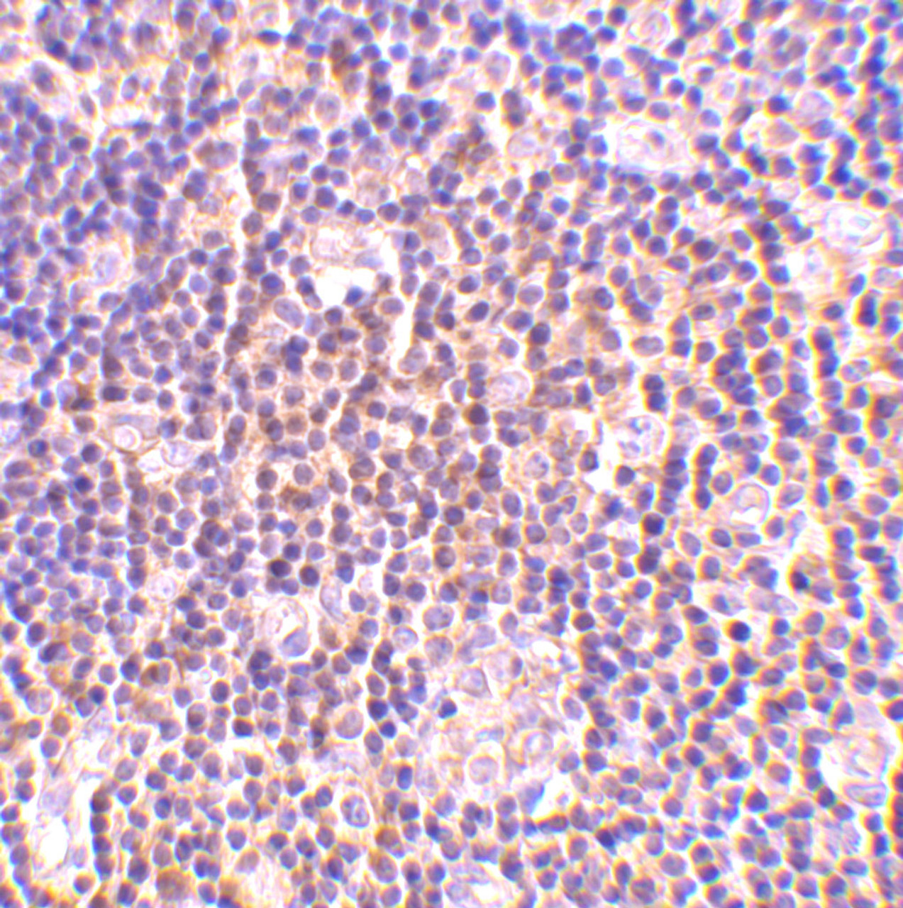 Immunohistochemistry of BAG-1 in human lymph node tissue with BAG-1 antibody at 2 ug/mL