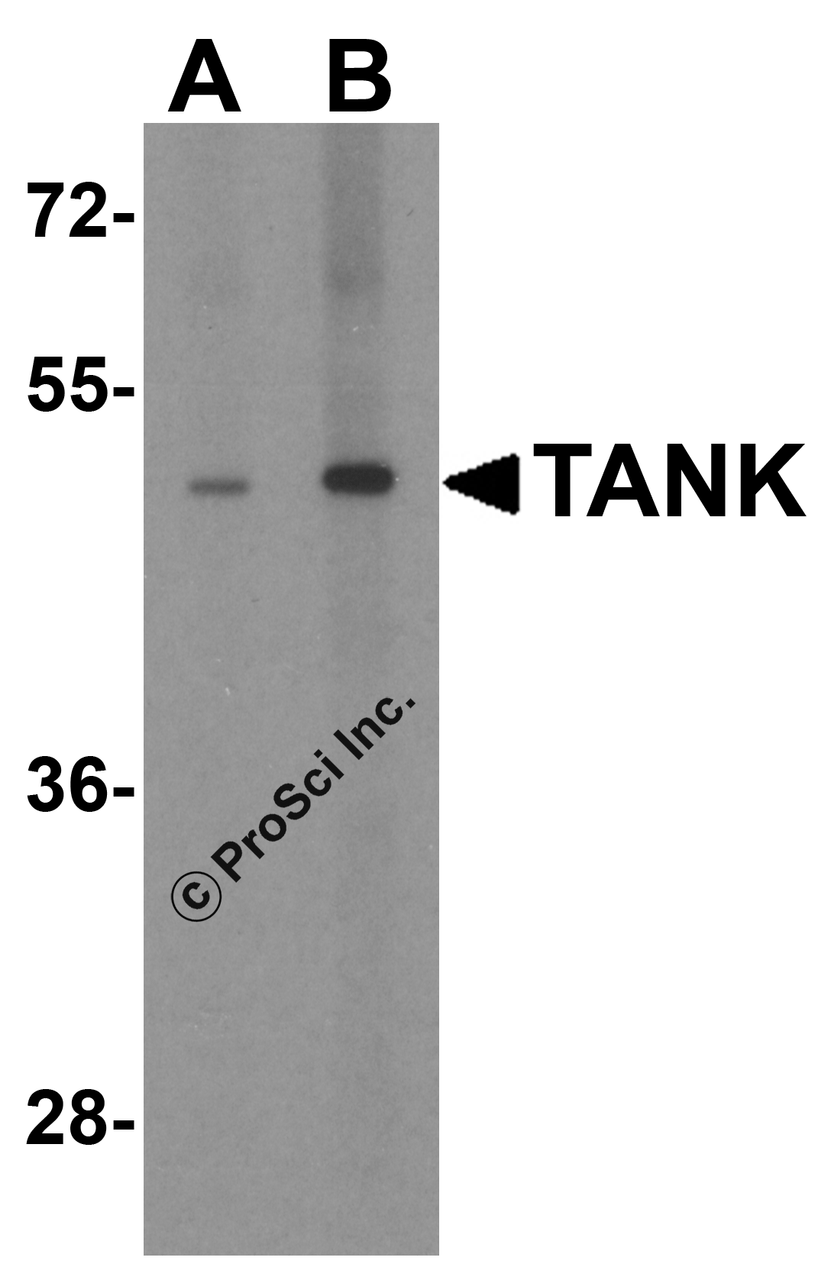 Western blot analysis of TANK in human kidney tissue lysate with TANK antibody at (A) 1 and (B) 2 &#956;g/mL.
