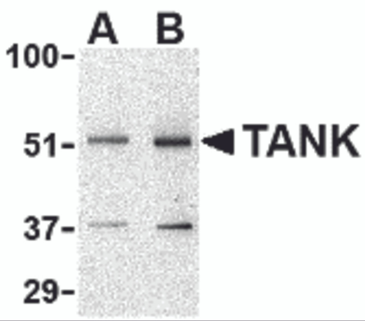 Western blot analysis of TANK in Daudi cell lysate with TANK antibody at (A) 0.5 and (B) 1 &#956;g/mL.