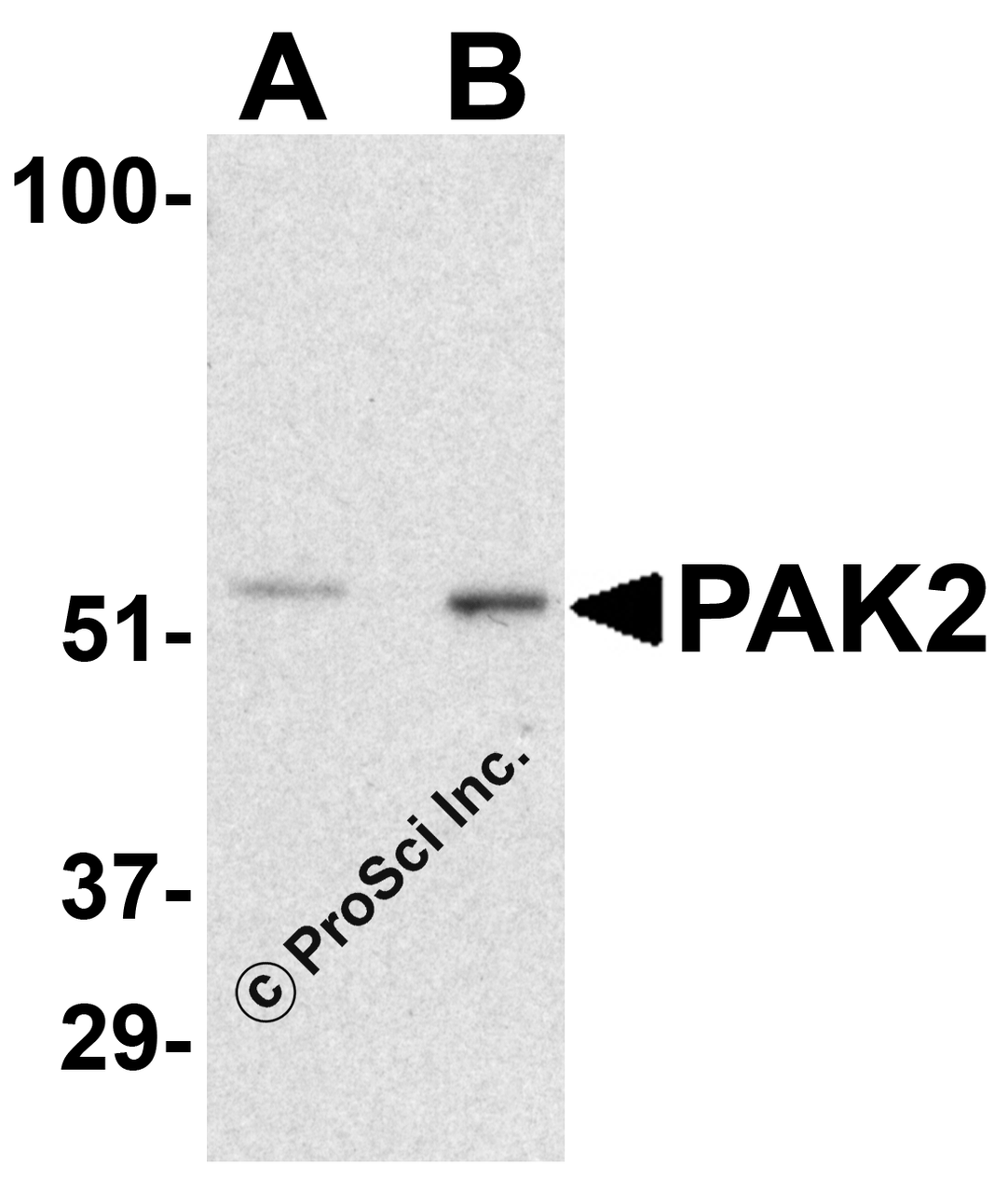 Figure 1 Western Blot Validation in Rat Bladder Tissue Lysate
Loading: 15 &#956;g of lysates per lane.
Antibodies: PAK2 3885 (A: 0.5 &#956;g/mL, B: 1 &#956;g/mL) , 1h incubation at RT in 5% NFDM/TBST.
Secondary: Goat anti-rabbit IgG HRP conjugate at 1:10000 dilution.