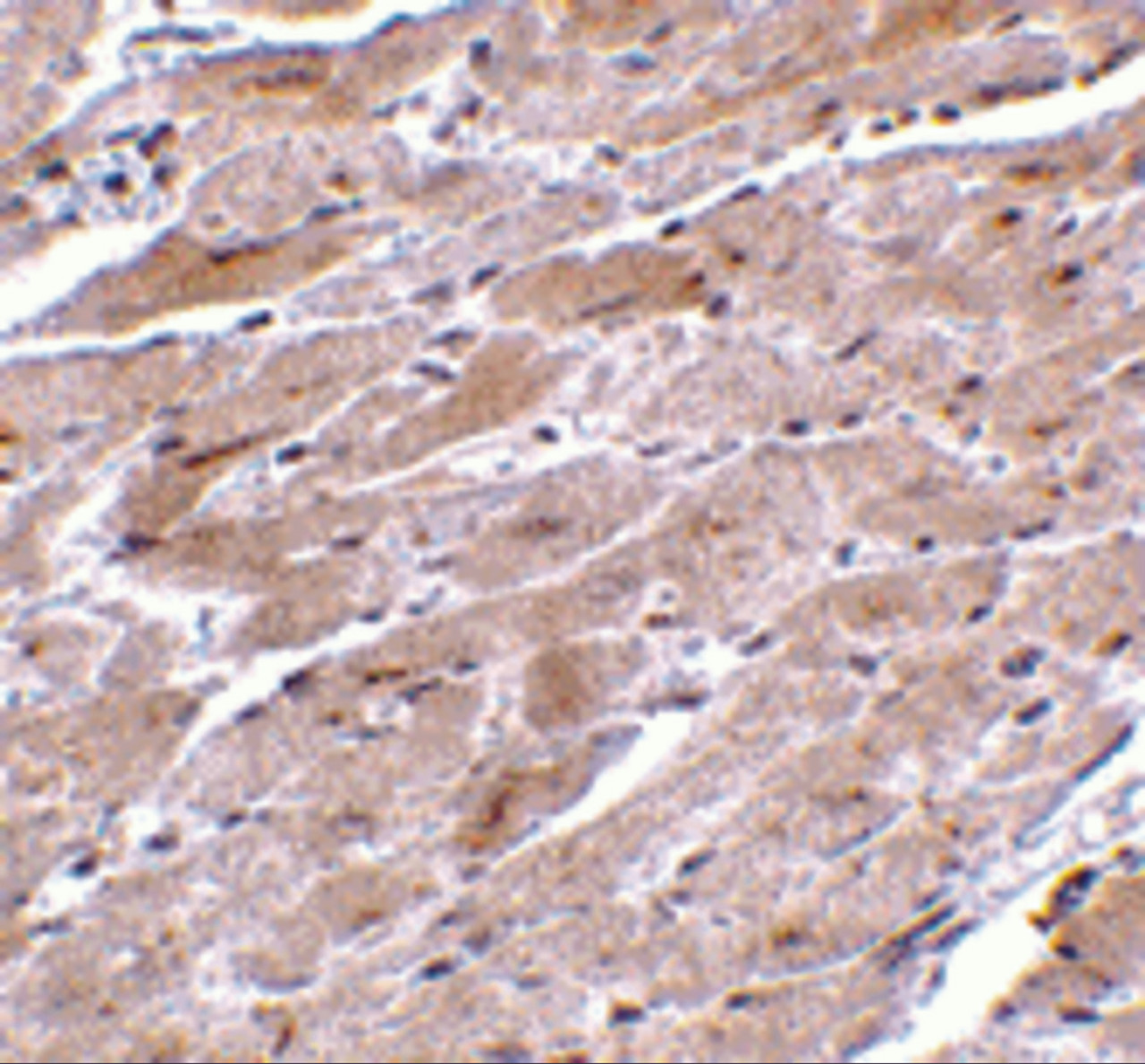 Immunohistochemistry of TRPC3 in mouse heart tissue with TRPC3 antibody at 10 ug/mL.