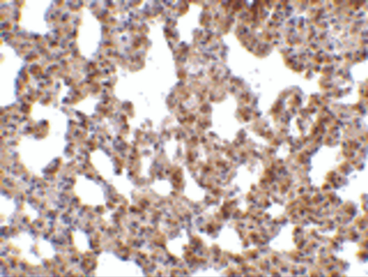 Immunohistochemistry of TRPC6 in mouse lung tissue with TRPC6 antibody at 10 ug/mL.