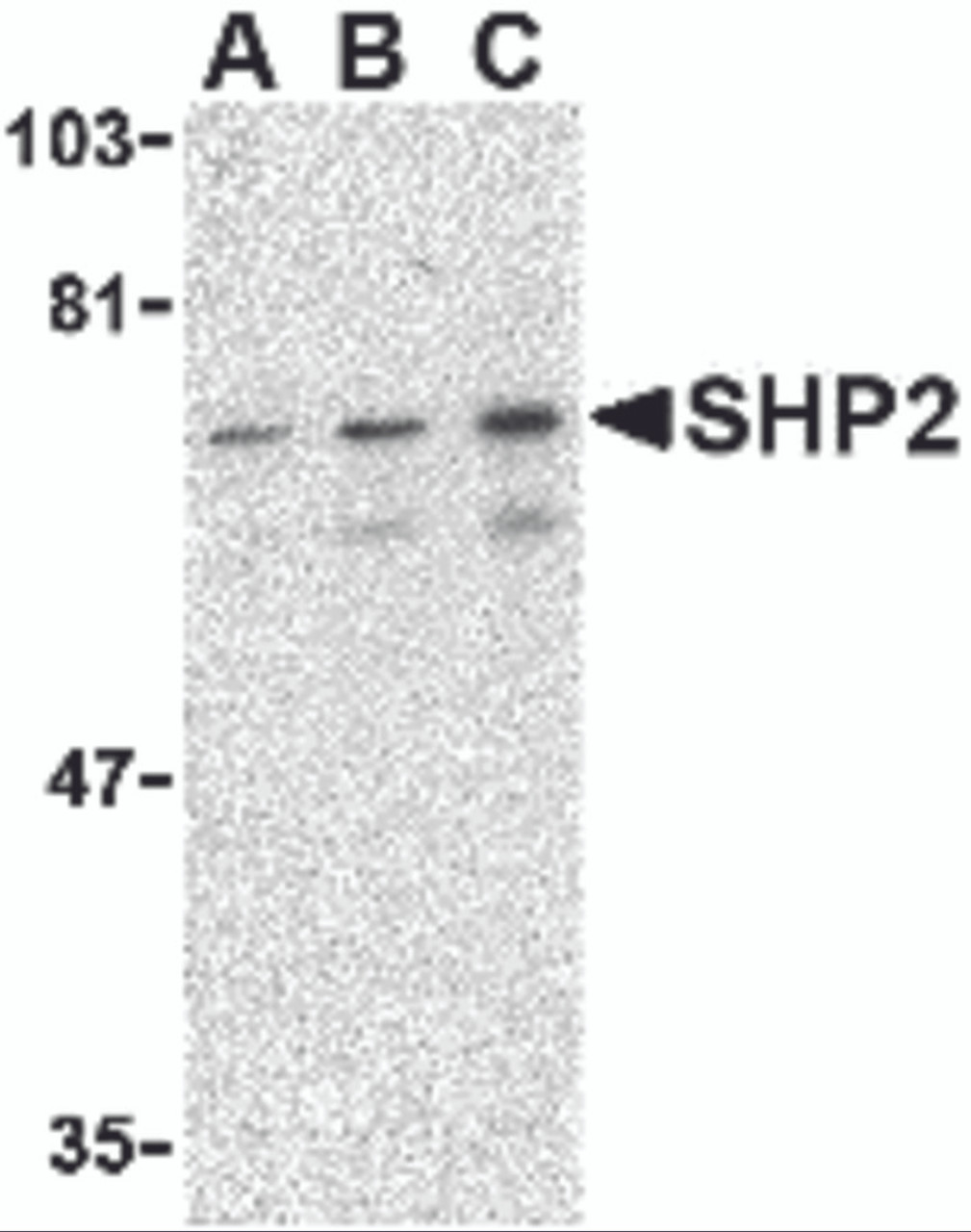 Western blot analysis of SHP2 in mouse skeletal muscle tissue lysate with SHP2 antibody at (A) 0.5, (B) 1 and (C) 2 &#956;g/mL.