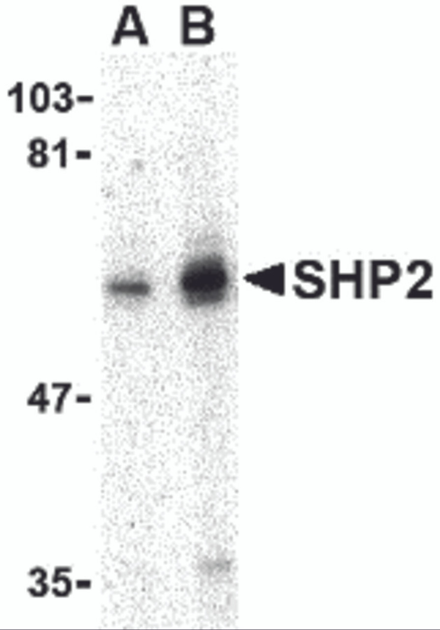 Western blot analysis of SHP2 in mouse skeletal muscle tissue lysate with SHP2 antibody at (A) 0.5 and (B) 1 &#956;g/mL.