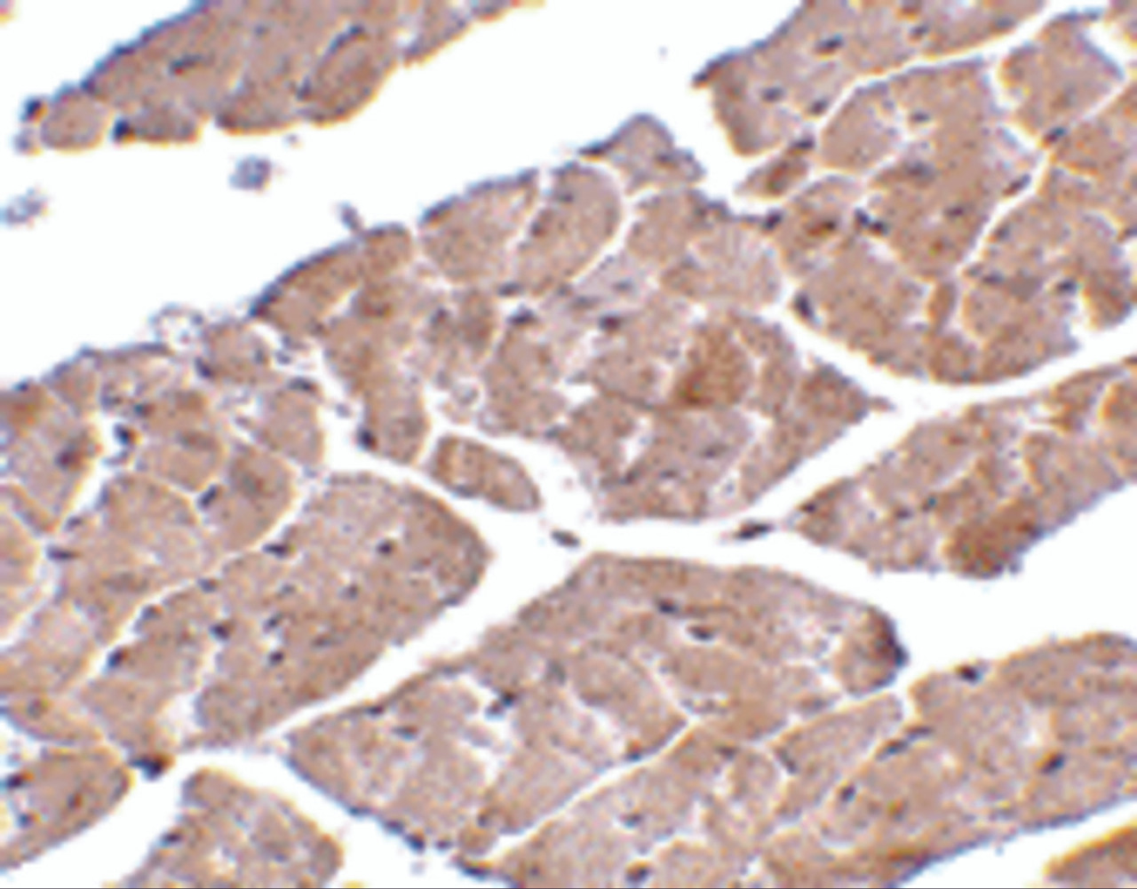 Immunohistochemistry of TRPC3 in mouse heart tissue with TRPC3 antibody at 2 ug/mL.