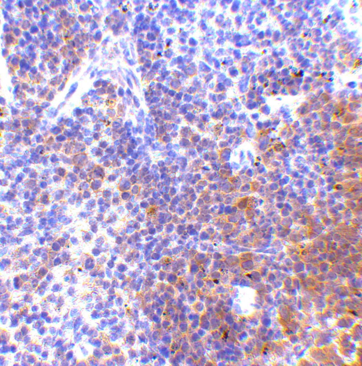 Immunohistochemistry of IRF7 in mouse spleen tissue with IRF7 antibody at 5 ug/mL.