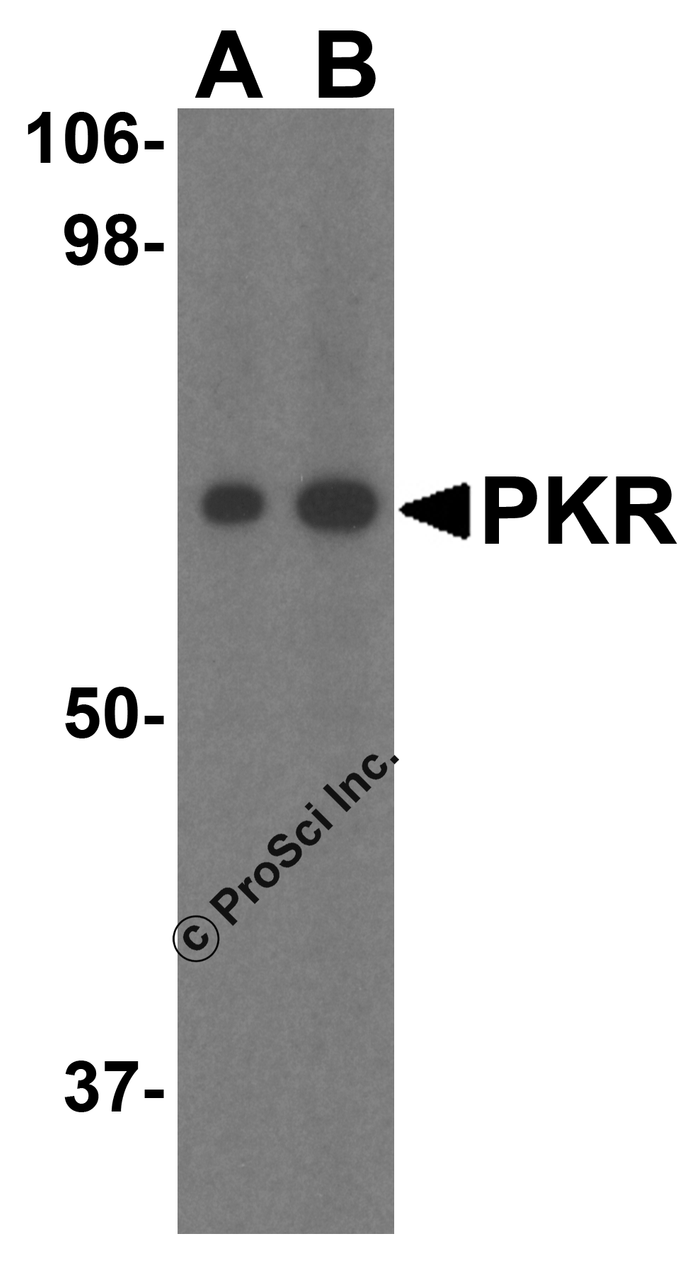 Figure 1 Western Blot Validation of PKR in MCF-7 Cells 
Loading: 15 &#956;g of lysates per lane.
Antibodies: PKR 3949 (A: 1 &#956;g/mL; B: 2 µg/mL) , 1h incubation at RT in 5% NFDM/TBST.
Secondary: Goat anti-rabbit IgG HRP conjugate at 1:10000 dilution.