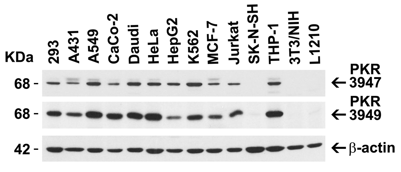 Figure 2 Independent Antibody Validation (IAV) via Protein Expression Profile in Cell Lines
Loading: 15 ug of lysates per lane.
Antibodies: PKR 3947 (1 ug/mL) , PKR 3949 (1 ug/mL, and beta-actin (1 ug/mL) , 1h incubation at RT in 5% NFDM/TBST.
Secondary: Goat anti-rabbit IgG HRP conjugate at 1:10000 dilution.