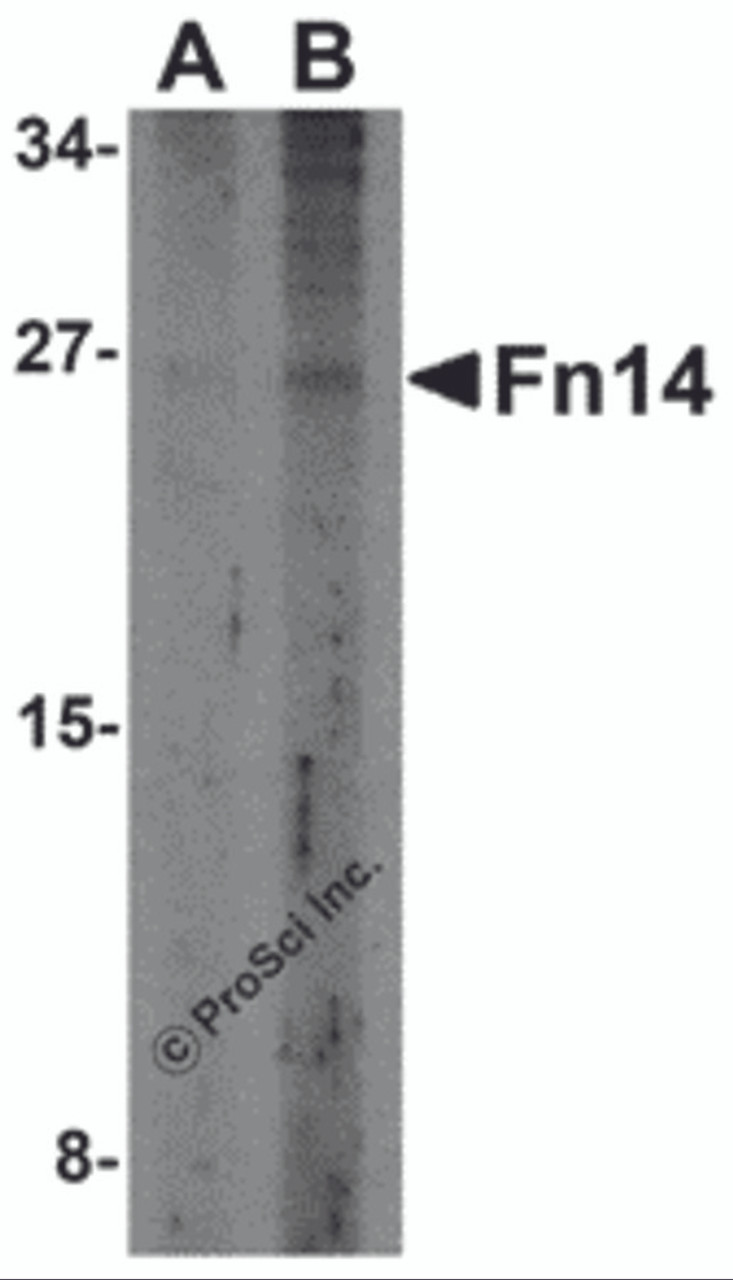 Western blot analysis of Fn14 in HepG2 cells with Fn14 antibody at (A) 2 and (B) 4 &#956;g/mL.
