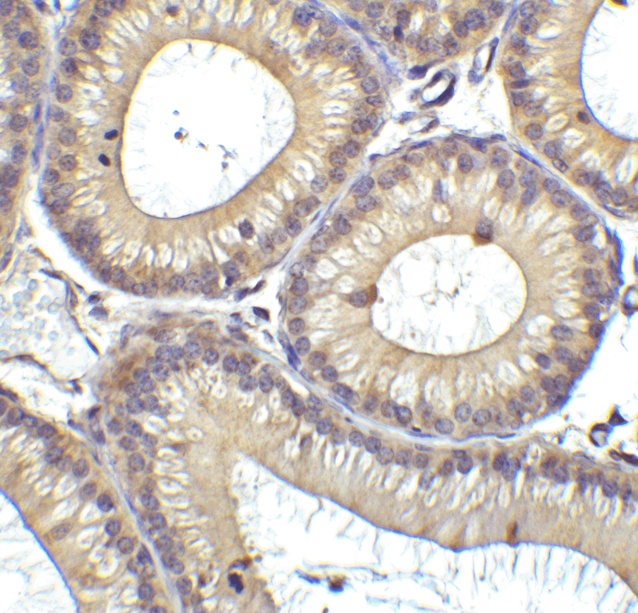 Immunohistochemistry of RIG-1 in mouse testis tissue with RIG-1 Antibody at 1 ug/mL.