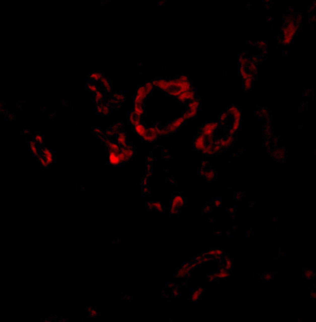 Immunofluorescence of Slug in human kidney tissue with Slug antibody at 20 ug/mL.